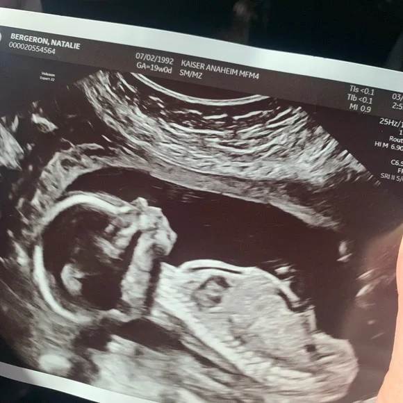 My first grandbaby is on the way! It’s a sweet baby girl! 🍼🐣🍼💕 - Picture 2 of 2